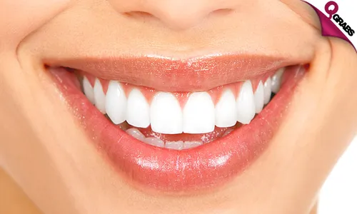 Teeth Whitening OR Home Bleaching Kit + Consultation!